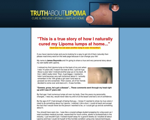 Fresh! – Fact About Lipoma. High conversions + 75% price!